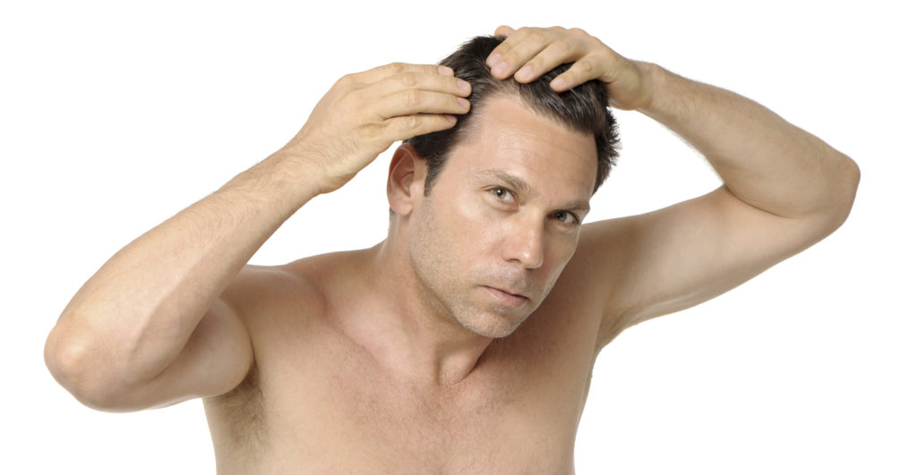 Man Inspecting Receding Hairline Baldness on White